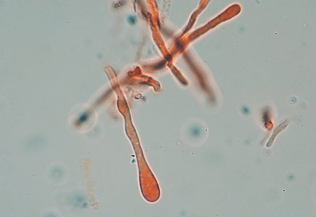 Fotoreportage di uno Stereum (credo!) (Stereum gausapatum)
